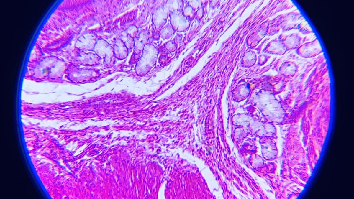 Scientists Reportedly Reversed Type 1 Diabetes by Reprogramming Patient’s Fat Cells into Insulin-Producing Cells