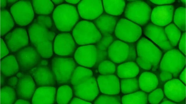 New Cartilage Type Found: Lipocartilage Resembles Fat, Boosts Elasticity