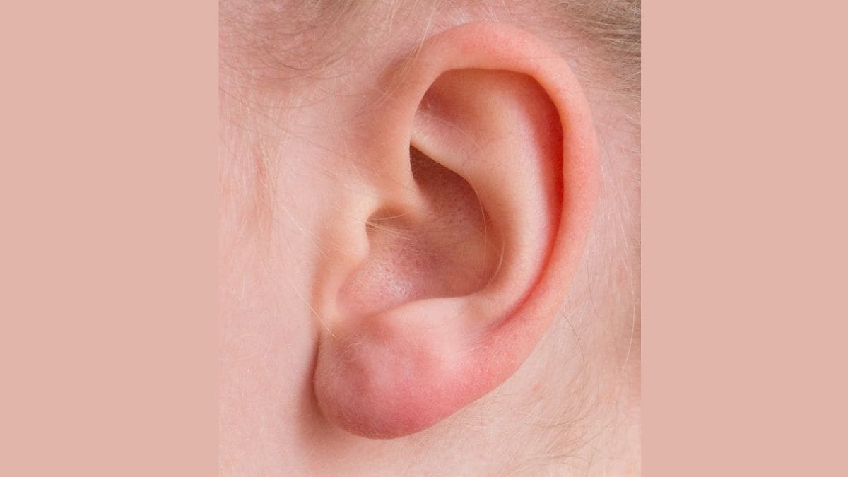 Ear Muscles Flex to Help Focus on Sounds, Study Reveals Evolutionary Link